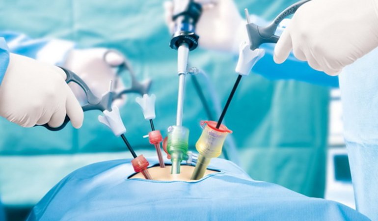 Laparoscopic Surgery