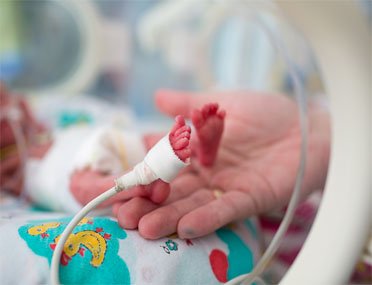Newborn Surgery in Vellore